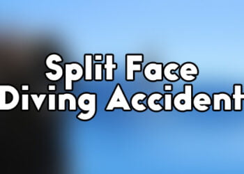 Split Face Diving Accident: Ein Unfall, der die Welt erschütterte