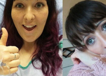 Kelly Ronahans Triumph: Medizinische Hürden mit Würde überwinden