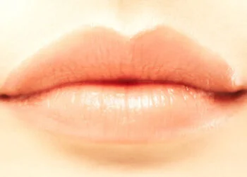Lip Augmentation in Berlin